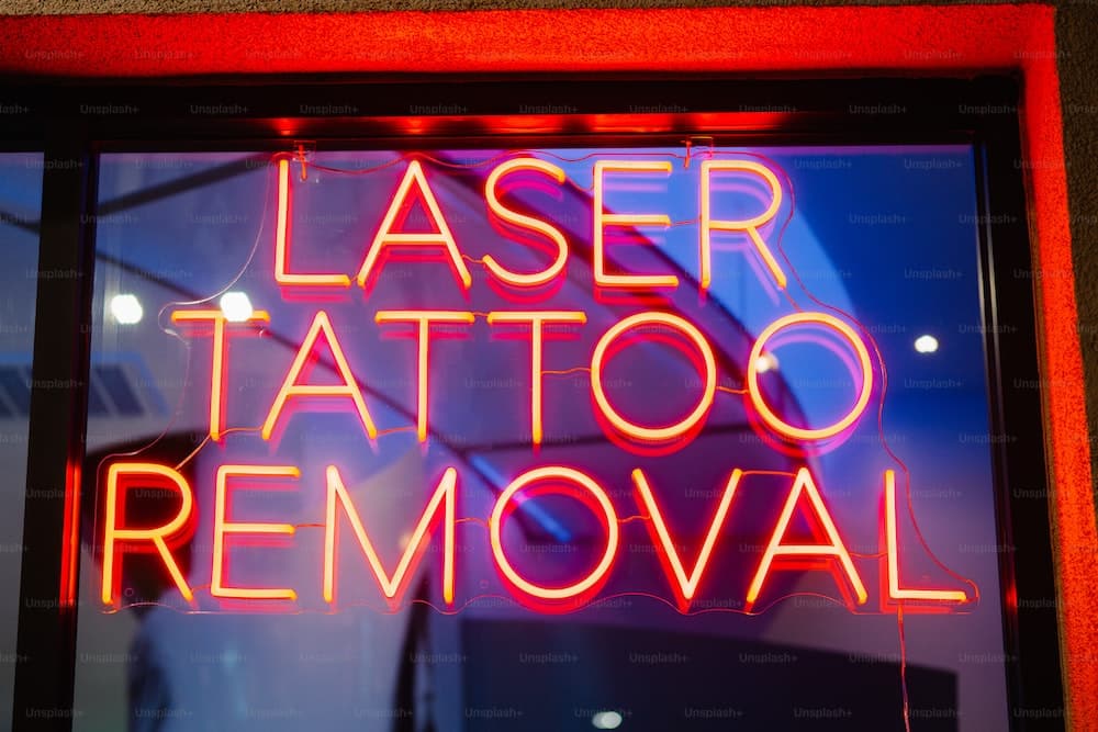 prix du détatouage laser